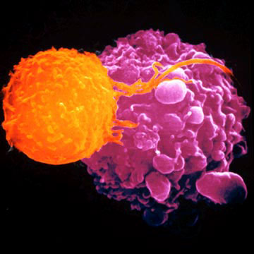 T-cell killing a cancer cell